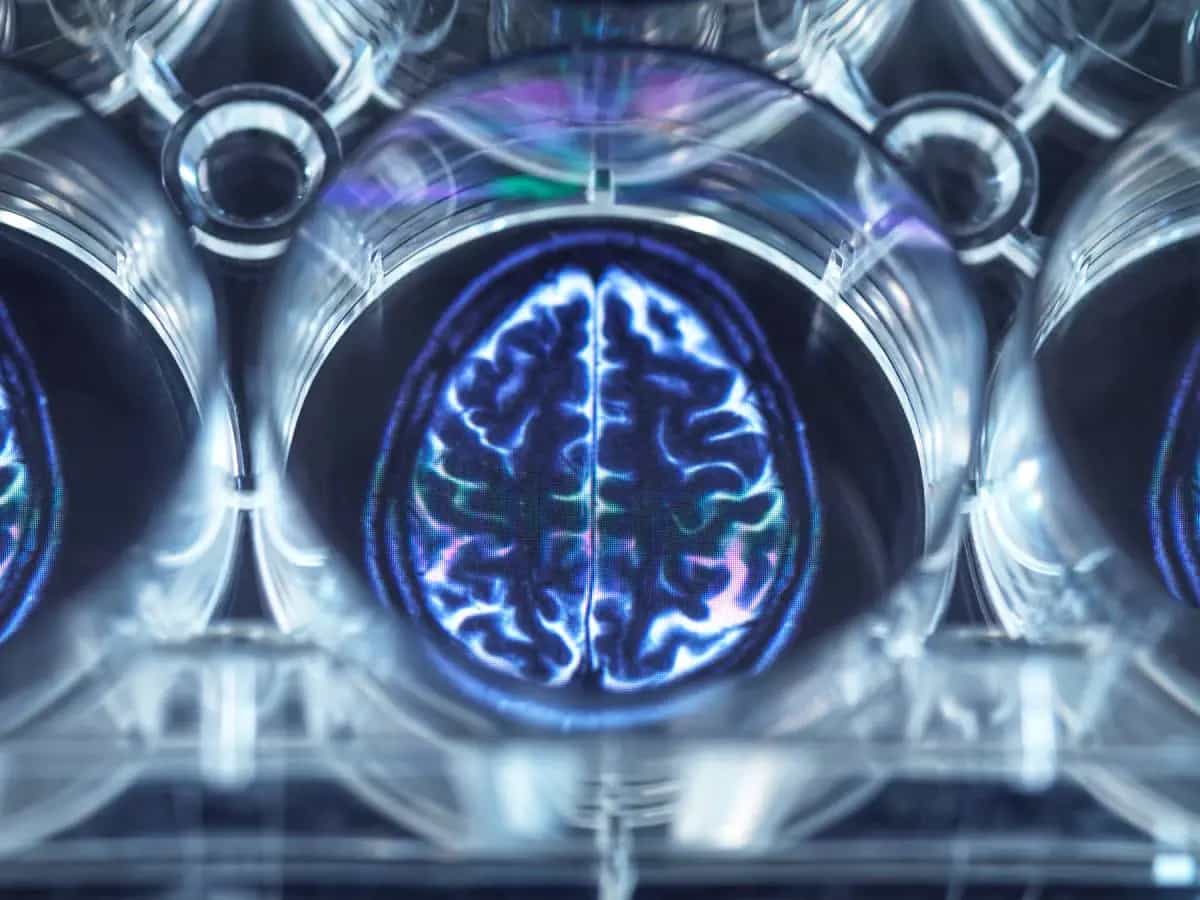 Le tracce di microplastiche nel cervello creano problemi alla salute mentale