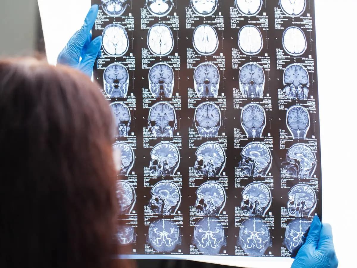 L’aria di cattiva qualità potrebbe aumentare il rischio di demenza